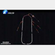 20150528�Aԥ֮�Tҕ�l�͹Pӛ:����,�������,������K,Խ�G���